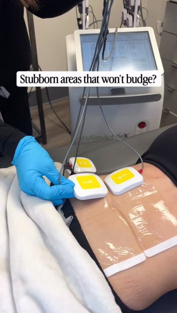 Whether it’s the lower stomach, thighs, or arms—sometimes even with workouts, healthy habits, and Charleston beach walks, certain areas just don’t want to cooperate. That’s where TruSculpt comes in ✨
At Well Labs+ Charleston, we love TruSculpt for its ability to help contour and sculpt stubborn areas with no surgery and little to no downtime. Perfect for getting summer-ready while still living your life 🤍
Charleston summer is here—boat days, beach weekends, weddings, vacations, and feeling confident in whatever you wear ☀️
Ready to start your summer sculpt? Visit the link in our bio to book your treatment today ✨
#charlestonmedspa #trusculpt #charlestonwellness #abroutine #aesthetics